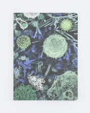 Infectious Disease Softcover - Lined